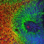 Universidade de Coimbra conquista 1,2 milhões de euros para estudar o autismo