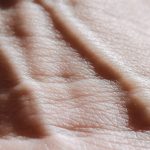 Aterosclerose: compreensão e prevenção